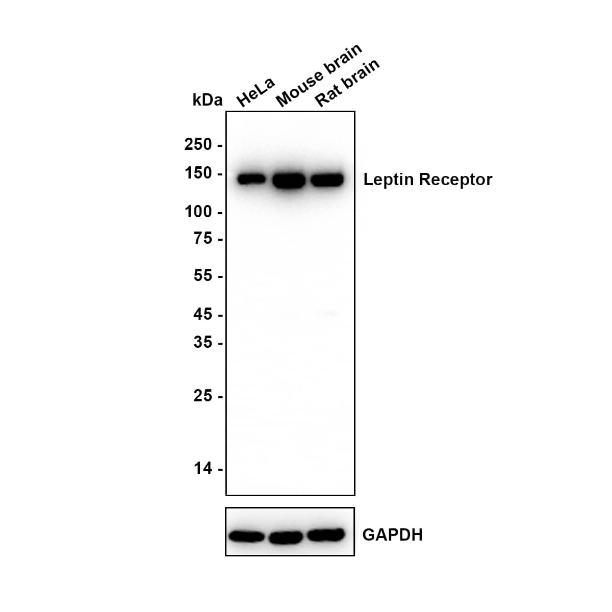 Leptin R Antibody (JA73-01) Western Blot: Leptin R Antibody (JA73-01) [NBP2-66931]
