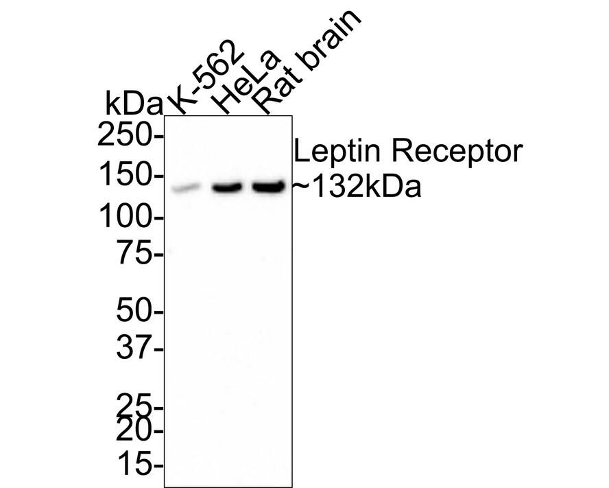 Leptin R Antibody (JA73-01) Western Blot: Leptin R Antibody (JA73-01) [NBP2-66931]