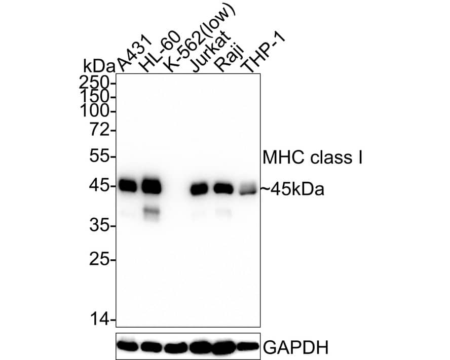 MHC Class I Antibody (JF10-38) Western Blot: MHC Class I Antibody (JF10-38) [NBP2-66946]
