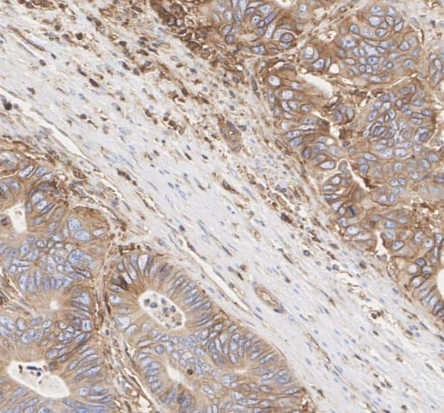 MHC Class I Antibody (JF10-38)