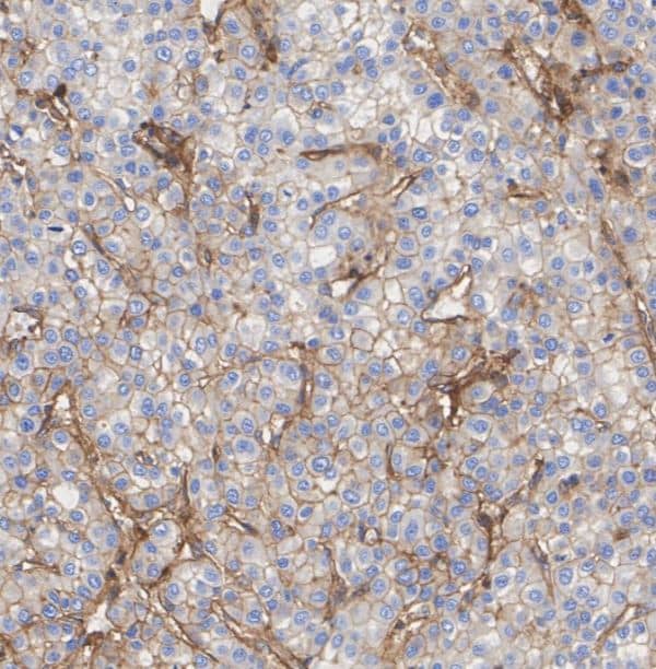 MHC Class I Antibody (JF10-38)