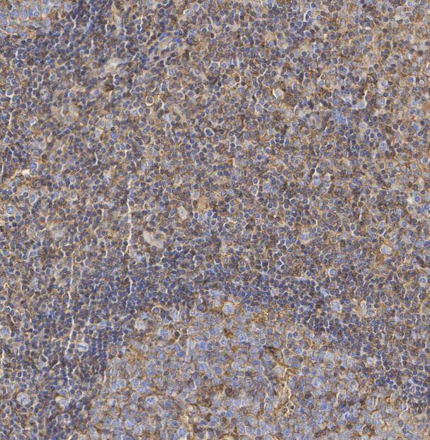MHC Class I Antibody (JF10-38)