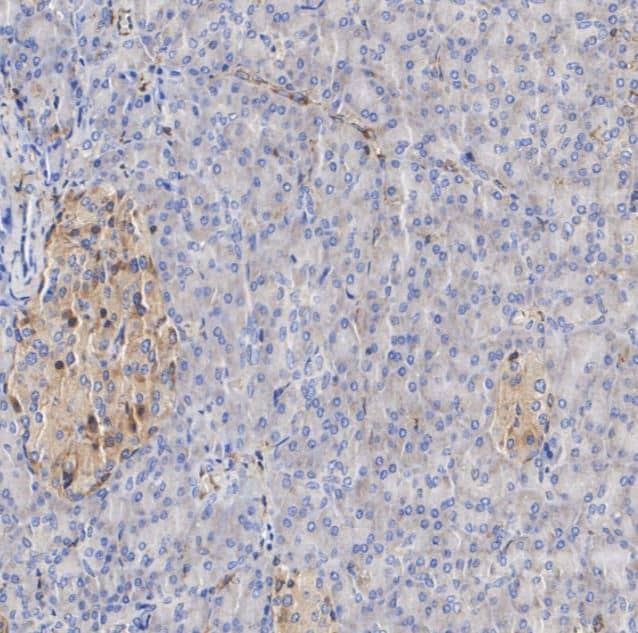 MHC Class I Antibody (JF10-38)