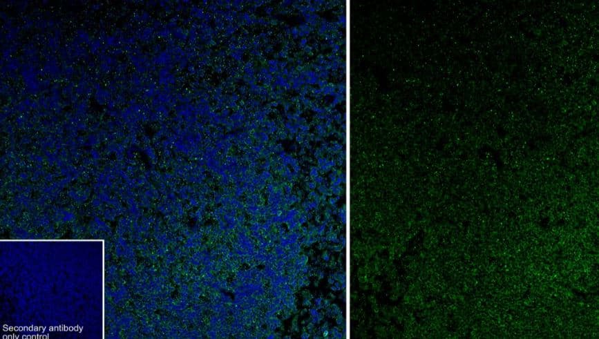 MLKL [p Ser345] Antibody (JM92-37)