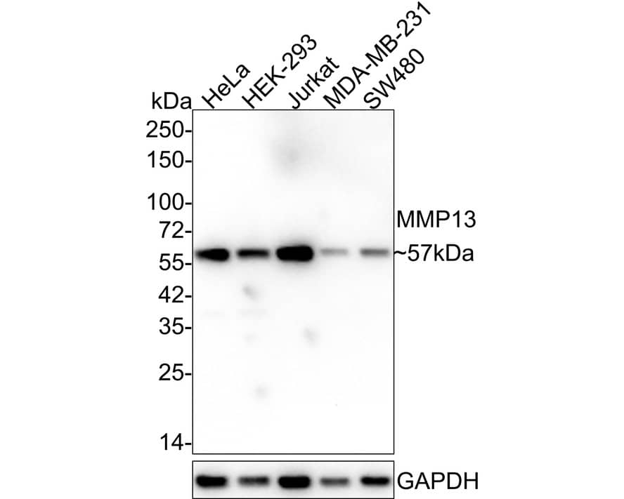 MMP-13 Antibody (JF0893) Western Blot: MMP-13 Antibody (JF0893) [NBP2-66954]