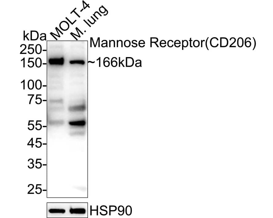 MMR/CD206/Mannose Receptor Antibody (JF0953) Western Blot: MMR/CD206/Mannose Receptor Antibody (JF0953) [NBP2-66956]