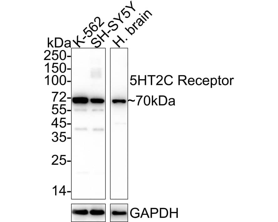 5-HT2C Antibody (JA31-31) Western Blot: 5-HT2C Antibody (JA31-31) [NBP2-67100]