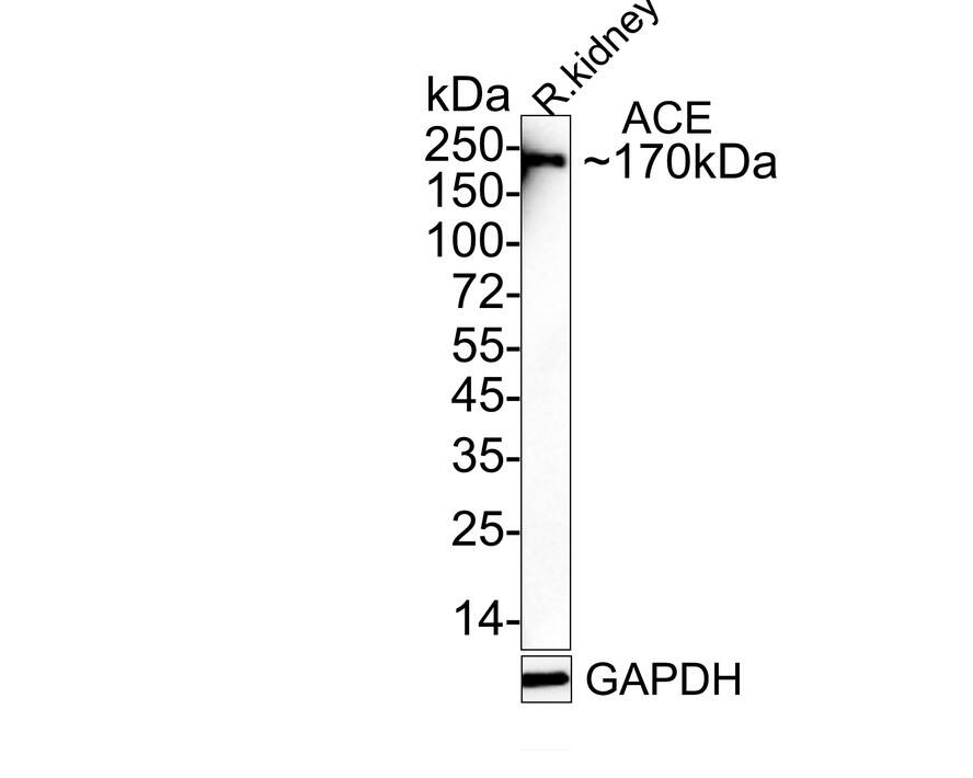 ACE/CD143 Antibody (JM59-32) Western Blot: ACE/CD143 Antibody (JM59-32) [NBP2-67111]