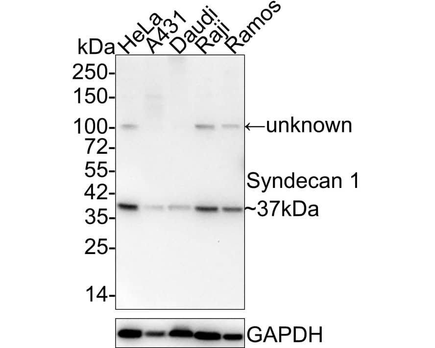 Syndecan-1/CD138 Antibody (JM11-21) Western Blot: Syndecan-1/CD138 Antibody (JM11-21) [NBP2-67174]