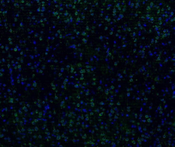TACE/ADAM17 Antibody (JM10-35)