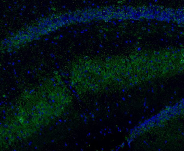 TACE/ADAM17 Antibody (JM10-35)