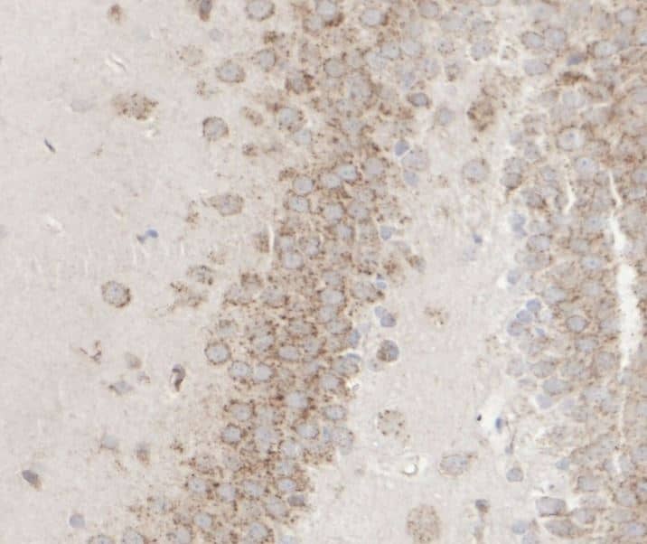 TACE/ADAM17 Antibody (JM10-35)