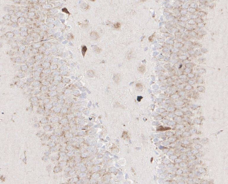 TACE/ADAM17 Antibody (JM10-35)