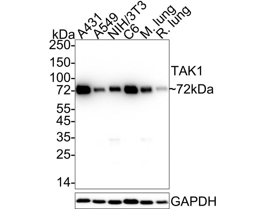 TAK1 Antibody (JM73-19) Western Blot: TAK1 Antibody (JM73-19) [NBP2-67180]