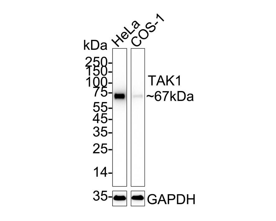 TAK1 Antibody (JM73-19) Western Blot: TAK1 Antibody (JM73-19) [NBP2-67180]