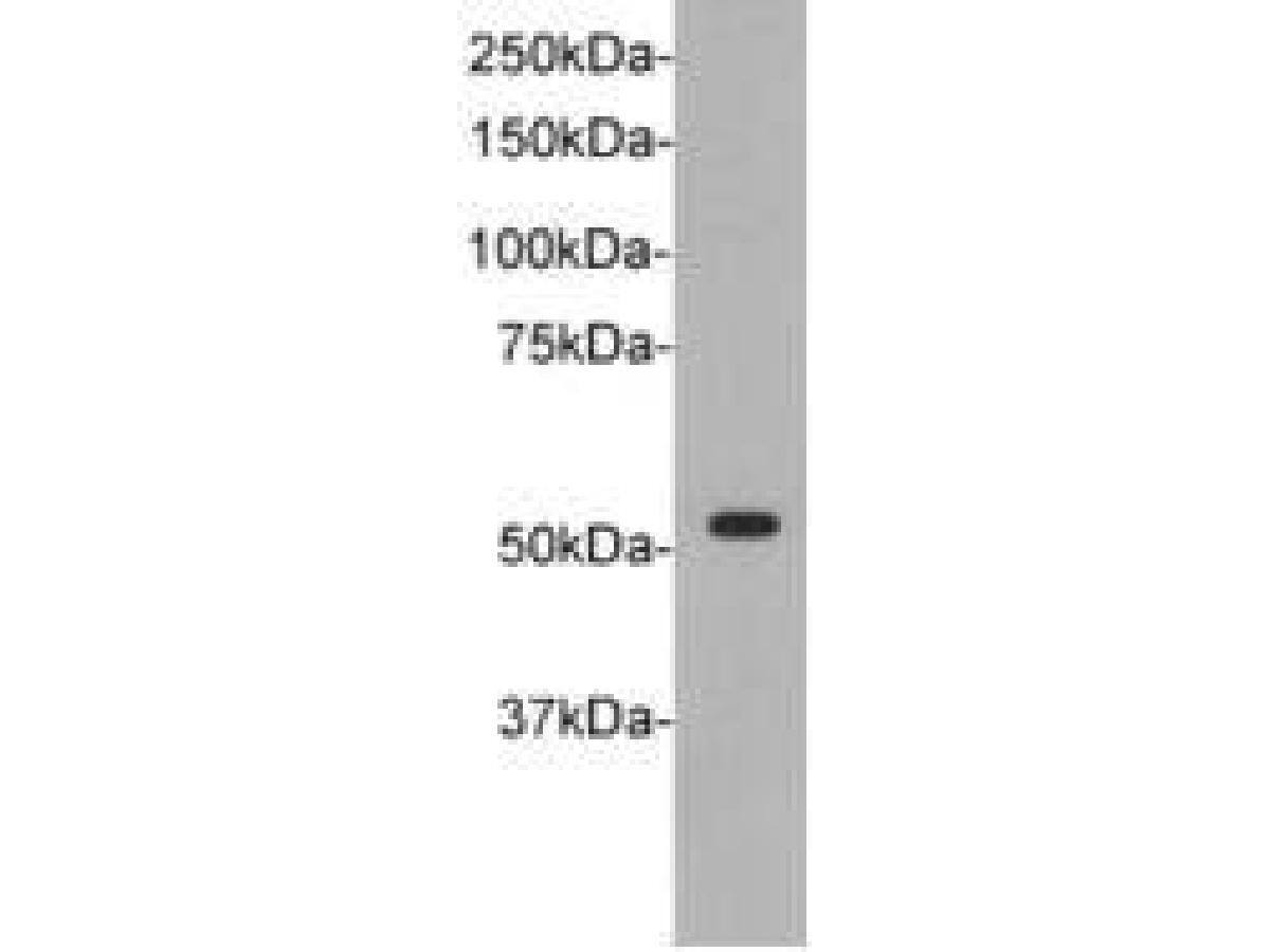 TdT Antibody (B4-F5) Western Blot: TdT Antibody (B4-F5) [NBP2-67185]