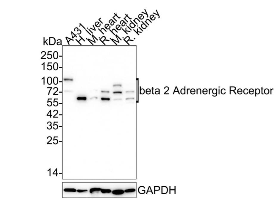 beta-2 Adrenergic R/ADRB2 Antibody (JM102-06)