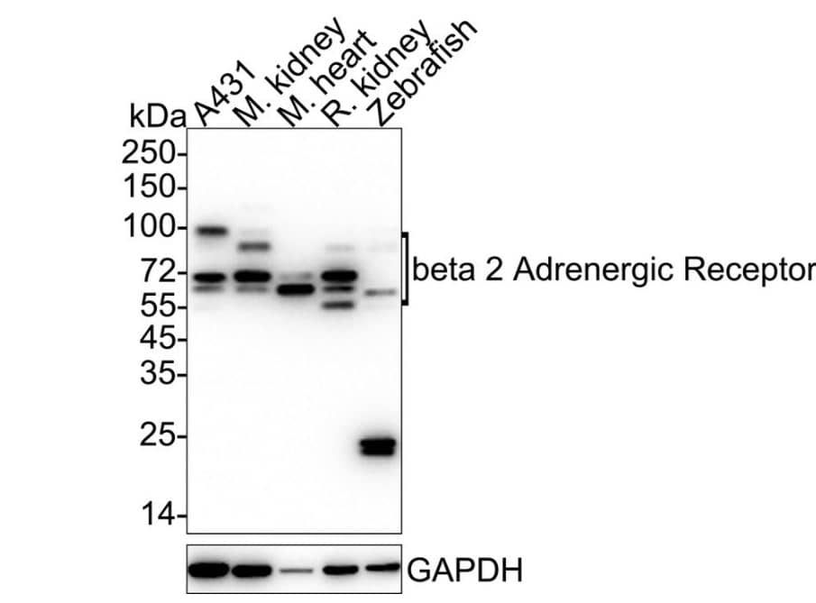 beta-2 Adrenergic R/ADRB2 Antibody (JM102-06)