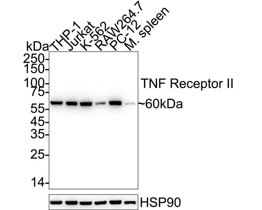 TNF RII/TNFRSF1B Antibody (JM113-01) Western Blot: TNF RII/TNFRSF1B Antibody (JM113-01) [NBP2-67218]