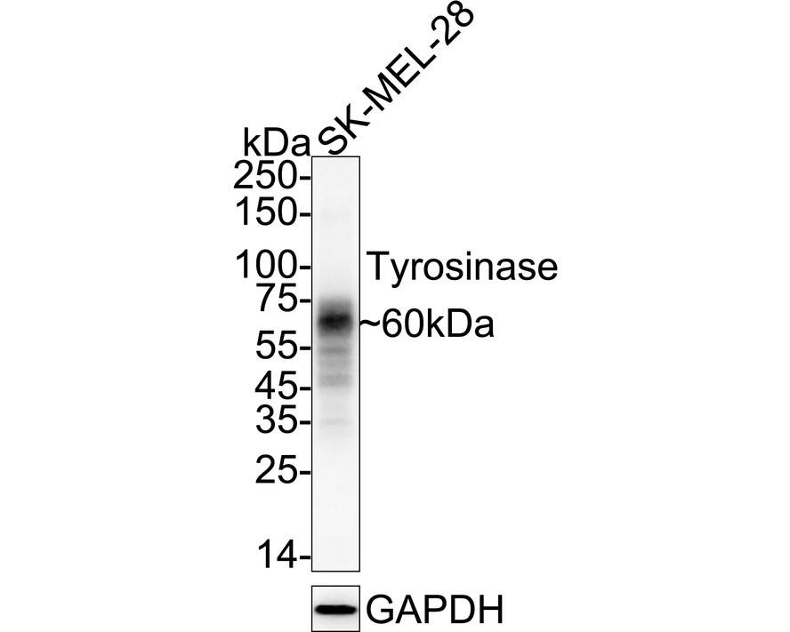 Tyrosinase Antibody (JA52-11) Western Blot: Tyrosinase Antibody (JA52-11) [NBP2-67232]