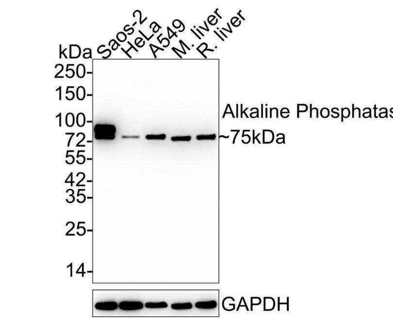 Alkaline Phosphatase, Tissue Non-Specific Antibody (SA40-00)
