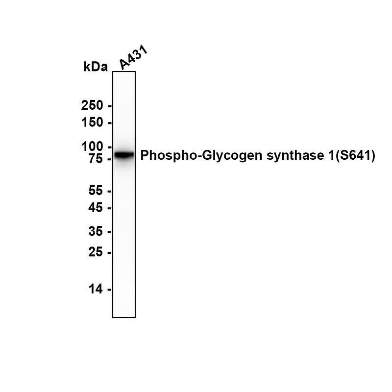 Glycogen Synthase [p Ser641] Antibody (SR46-06) Western Blot: Glycogen Synthase [p Ser641] Antibody (SR46-06) [NBP2-67315]