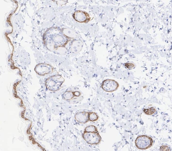 Collagen XVII Antibody (SR46-05)