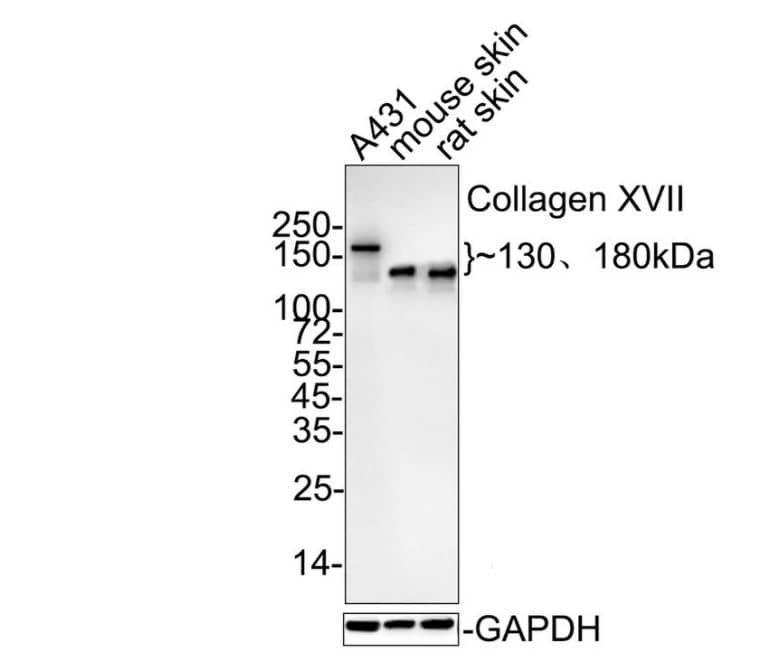 Collagen XVII Antibody (SR46-05)