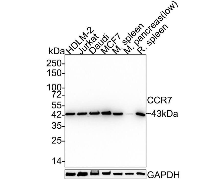CCR7 Antibody (SR36-04) Western Blot: CCR7 Antibody (SR36-04) [NBP2-67324]