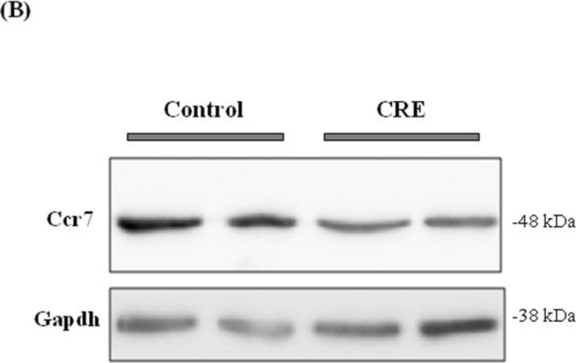CCR7 Antibody (SR36-04)