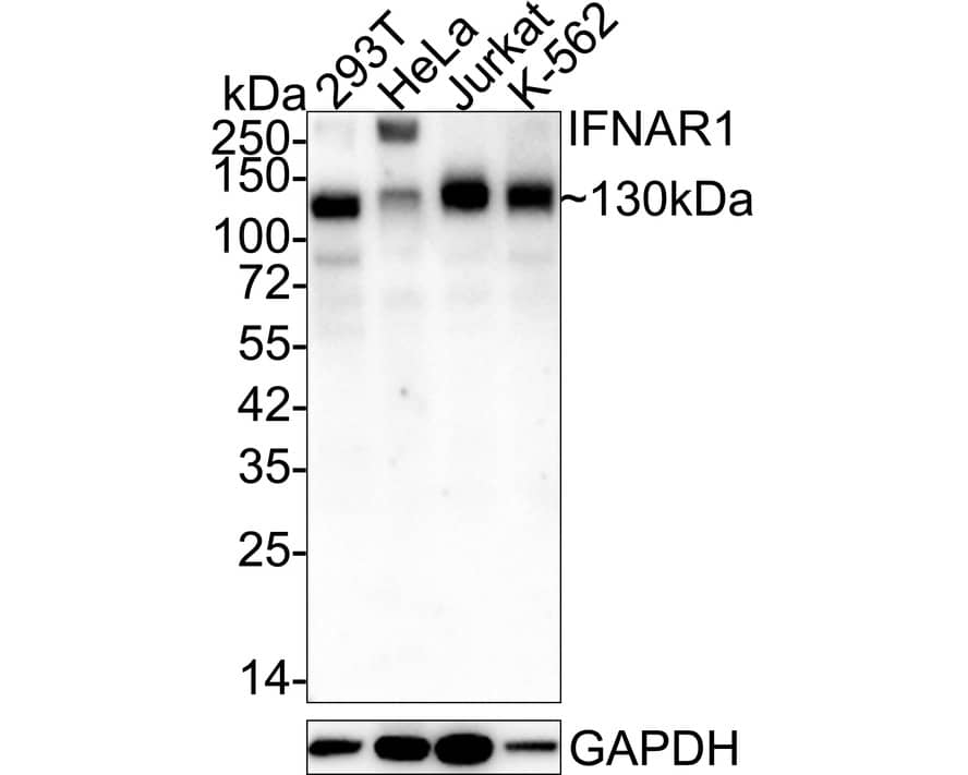 IFN-alpha/beta R1 Antibody (SR45-08) Western Blot: IFN-alpha/beta R1 Antibody (SR45-08) [NBP2-67339]