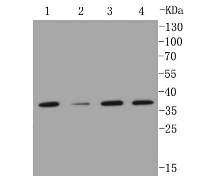 MMP-12 Antibody (SR03-23) Western Blot: MMP-12 Antibody (SR03-23) [NBP2-67344]