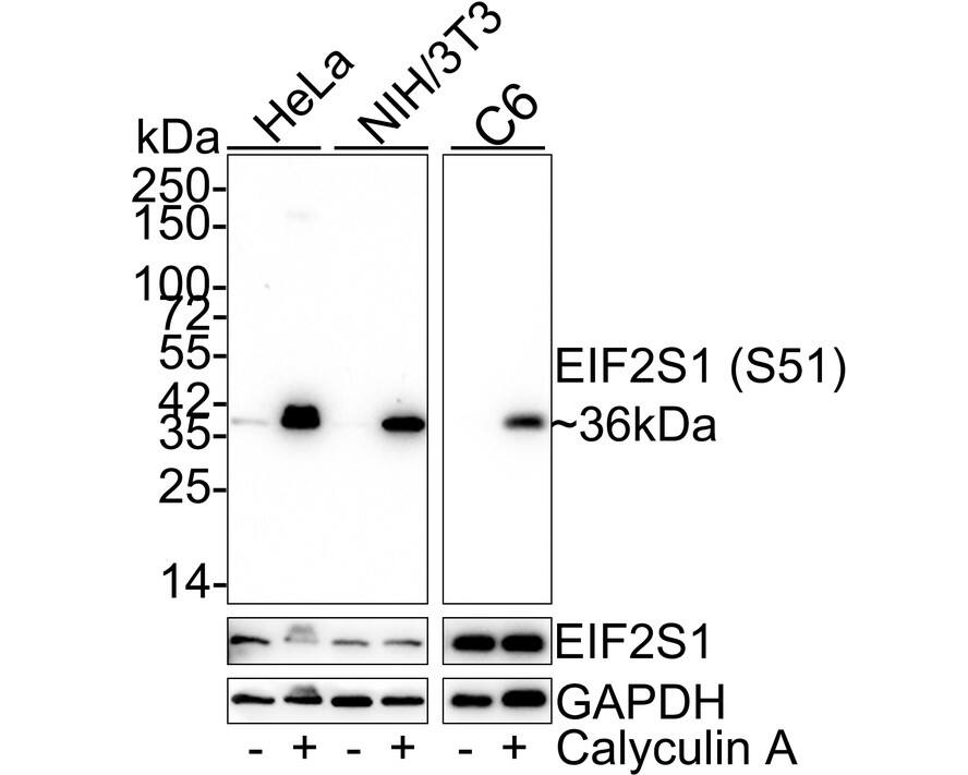 eIF2A [p Ser51] Antibody (SZ01-06) Western Blot: eIF2A [p Ser51] Antibody (SZ01-06) [NBP2-67353]
