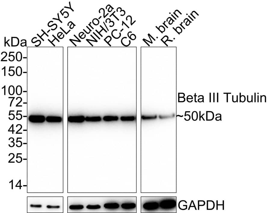 beta-III Tubulin Antibody (SP06-00) Western Blot: beta-III Tubulin Antibody (SP06-00) [NBP2-67374]