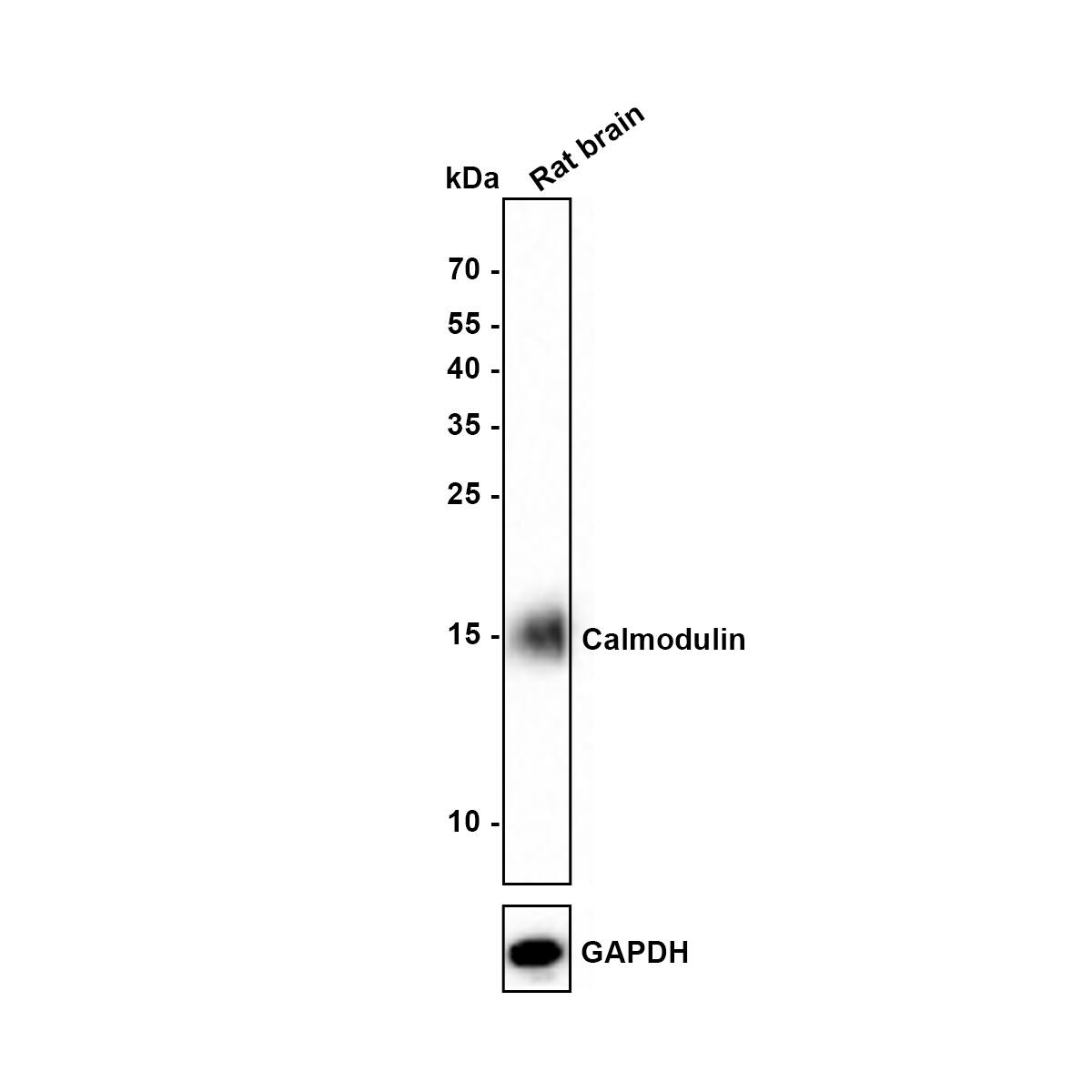 Calmodulin Antibody (SJ16-09) Western Blot: Calmodulin Antibody (SJ16-09) [NBP2-67413]