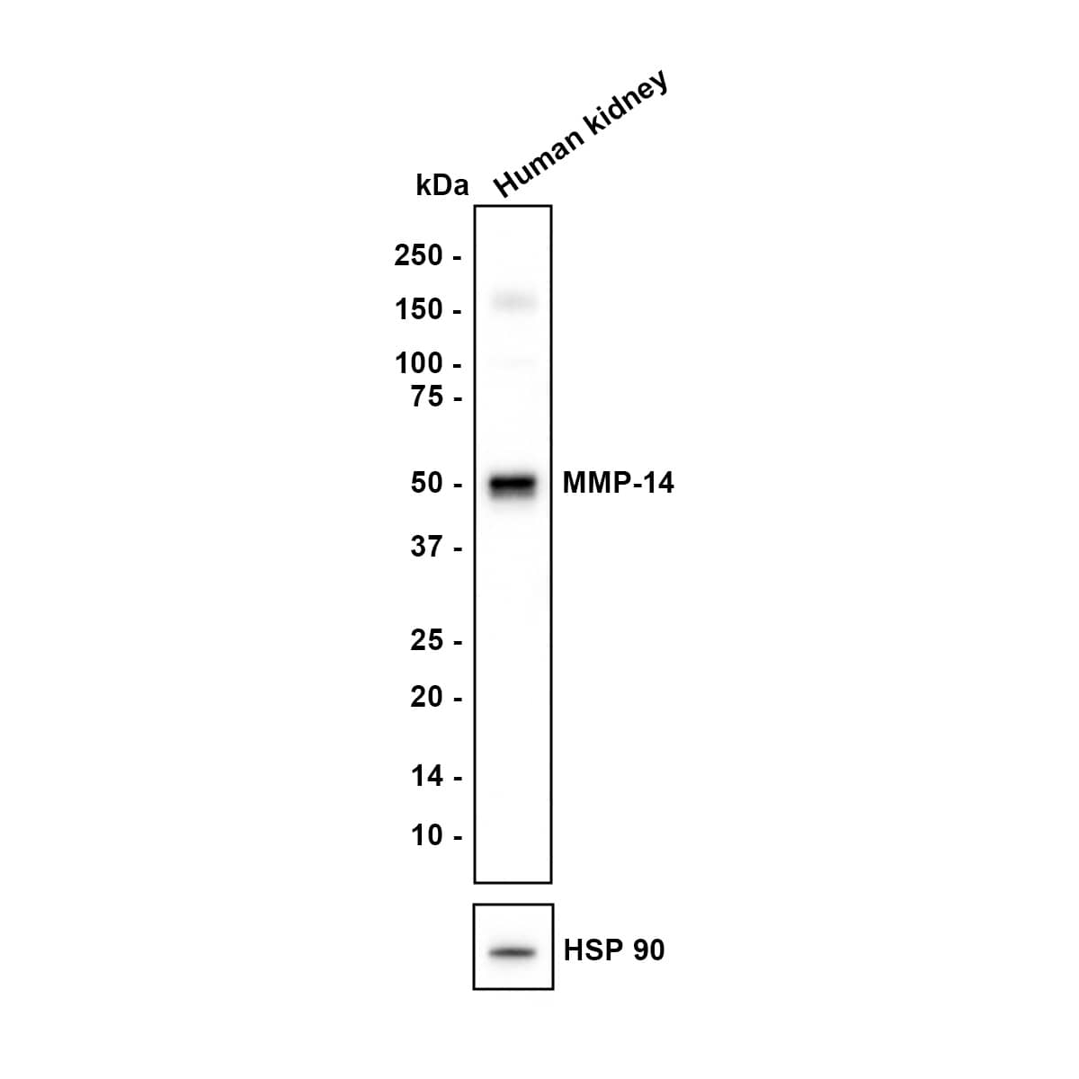 MMP-14/MT1-MMP Antibody (3-F7) Western Blot: MMP-14/MT1-MMP Antibody (3-F7) [NBP2-67415]