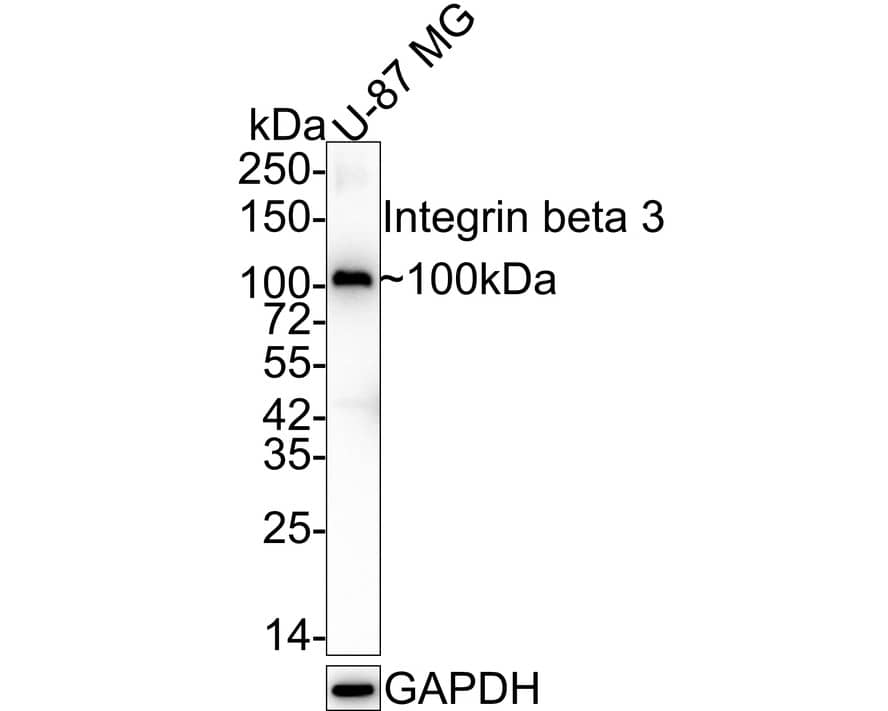 Integrin beta 3/CD61 Antibody (SJ19-09) Western Blot: Integrin beta 3/CD61 Antibody (SJ19-09) [NBP2-67416]