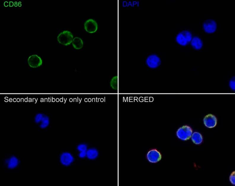 B7-2/CD86 Antibody (SJ20-00)