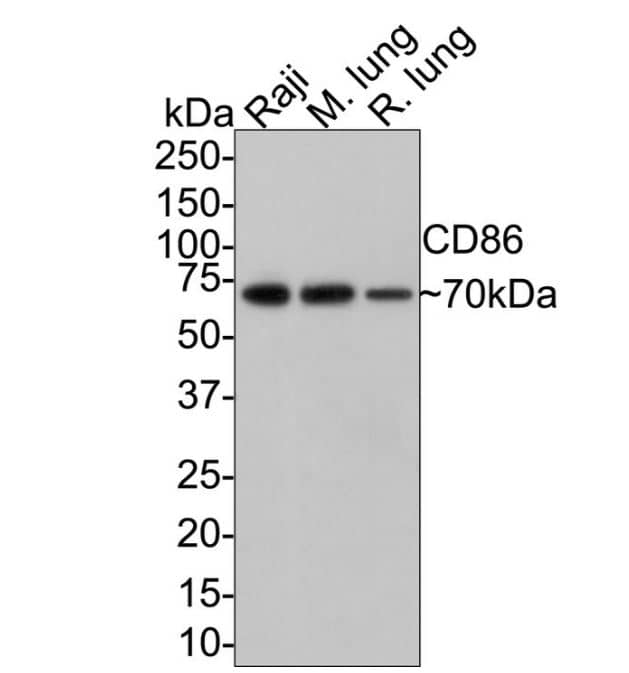 B7-2/CD86 Antibody (SJ20-00)