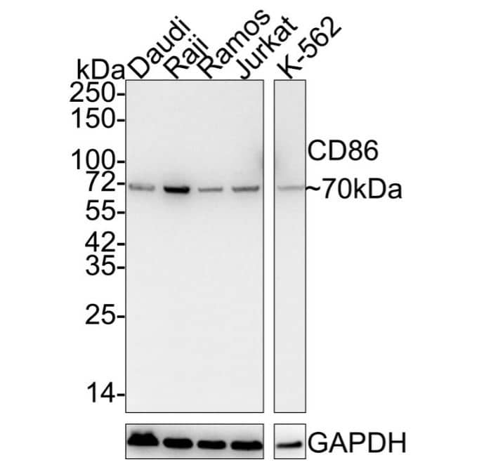 B7-2/CD86 Antibody (SJ20-00)