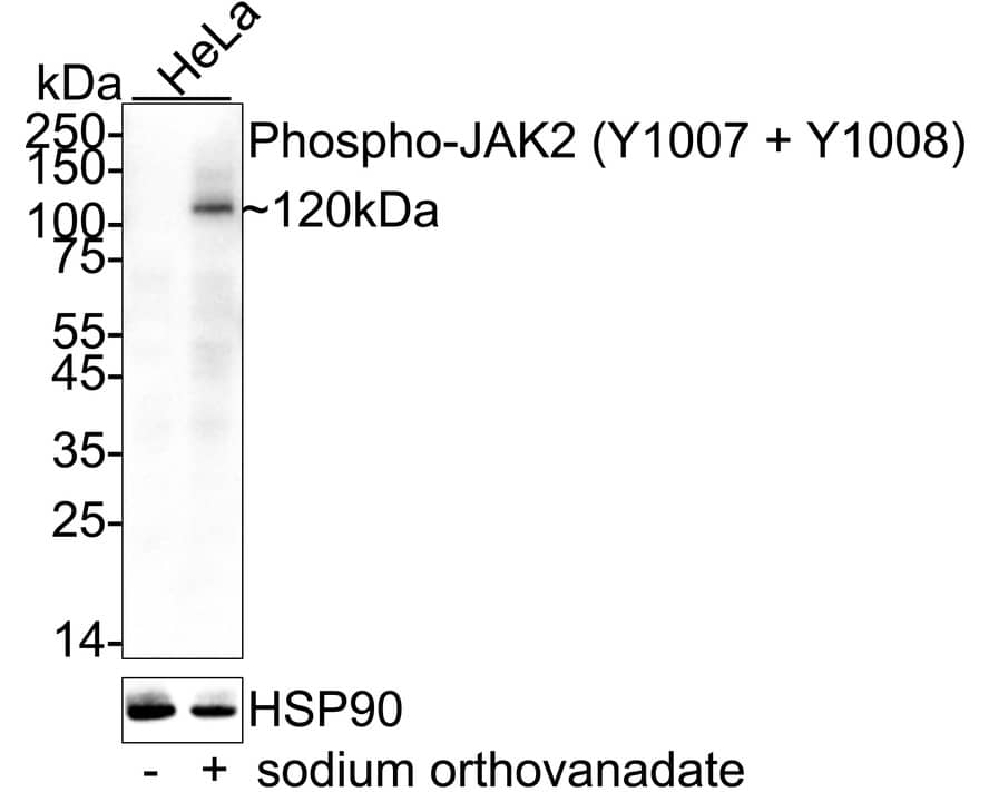 Jak2 [p Tyr1007, p Tyr1008] Antibody (SY24-03) Western Blot: Jak2 [p Tyr1007, p Tyr1008] Antibody (SY24-03) [NBP2-67429]