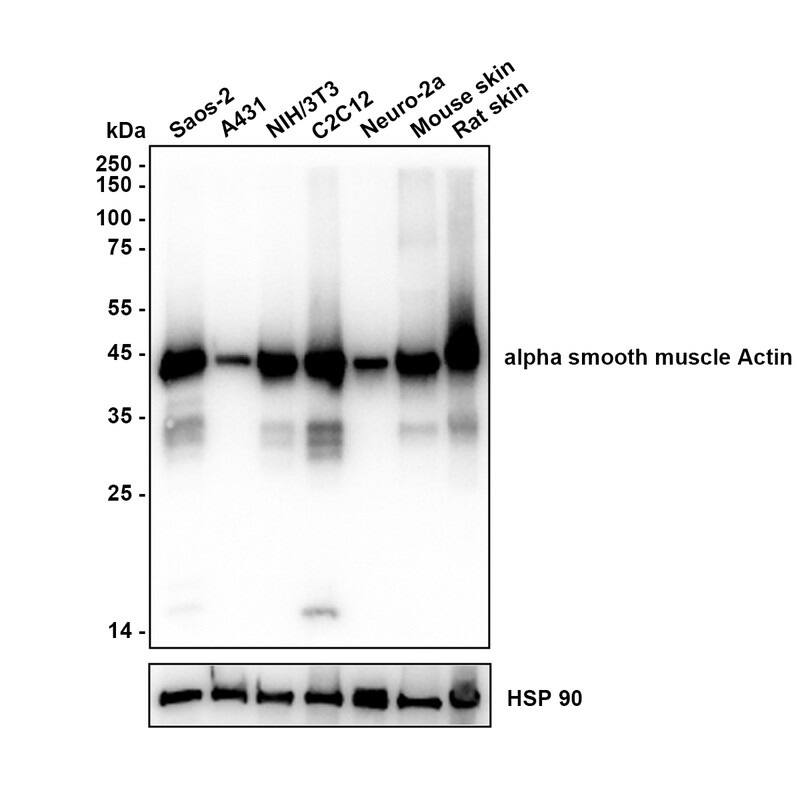 alpha-Smooth Muscle Actin Antibody (SY02-64) Western Blot: alpha-Smooth Muscle Actin Antibody (SY02-64) [NBP2-67440]