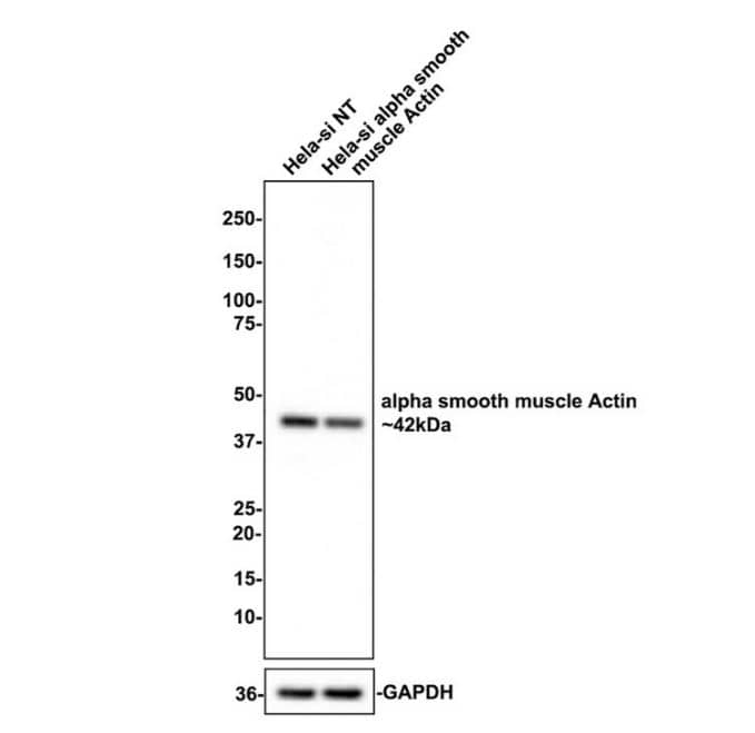 alpha-Smooth Muscle Actin Antibody (SY02-64)