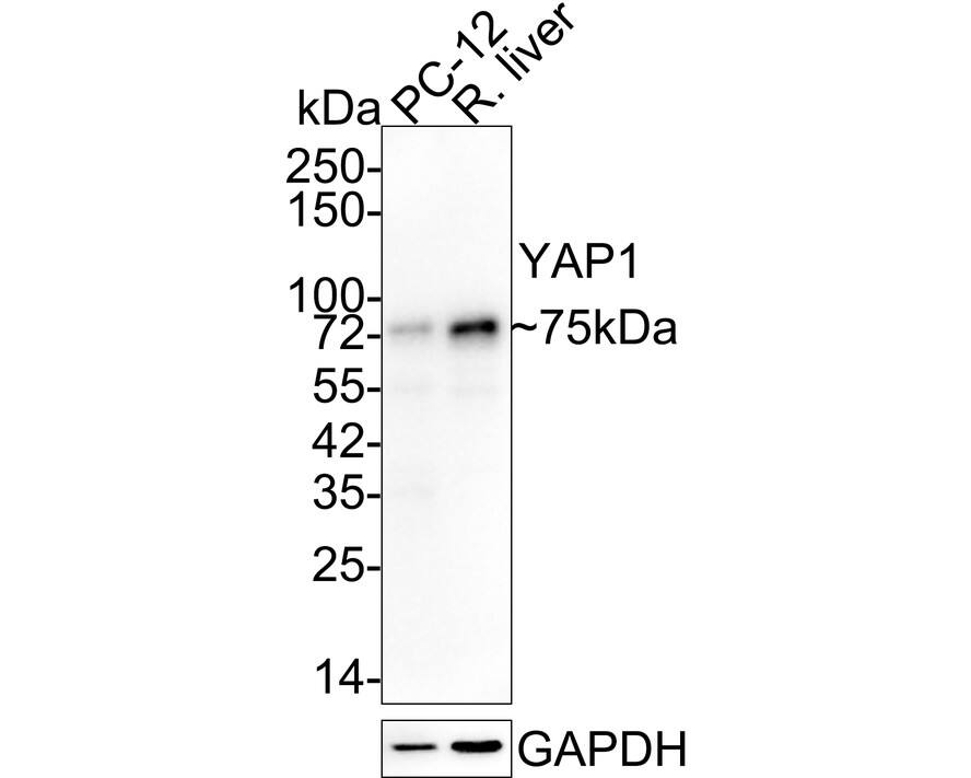 YAP1 Antibody (SU33-06) Western Blot: YAP1 Antibody (SU33-06) [NBP2-67467]