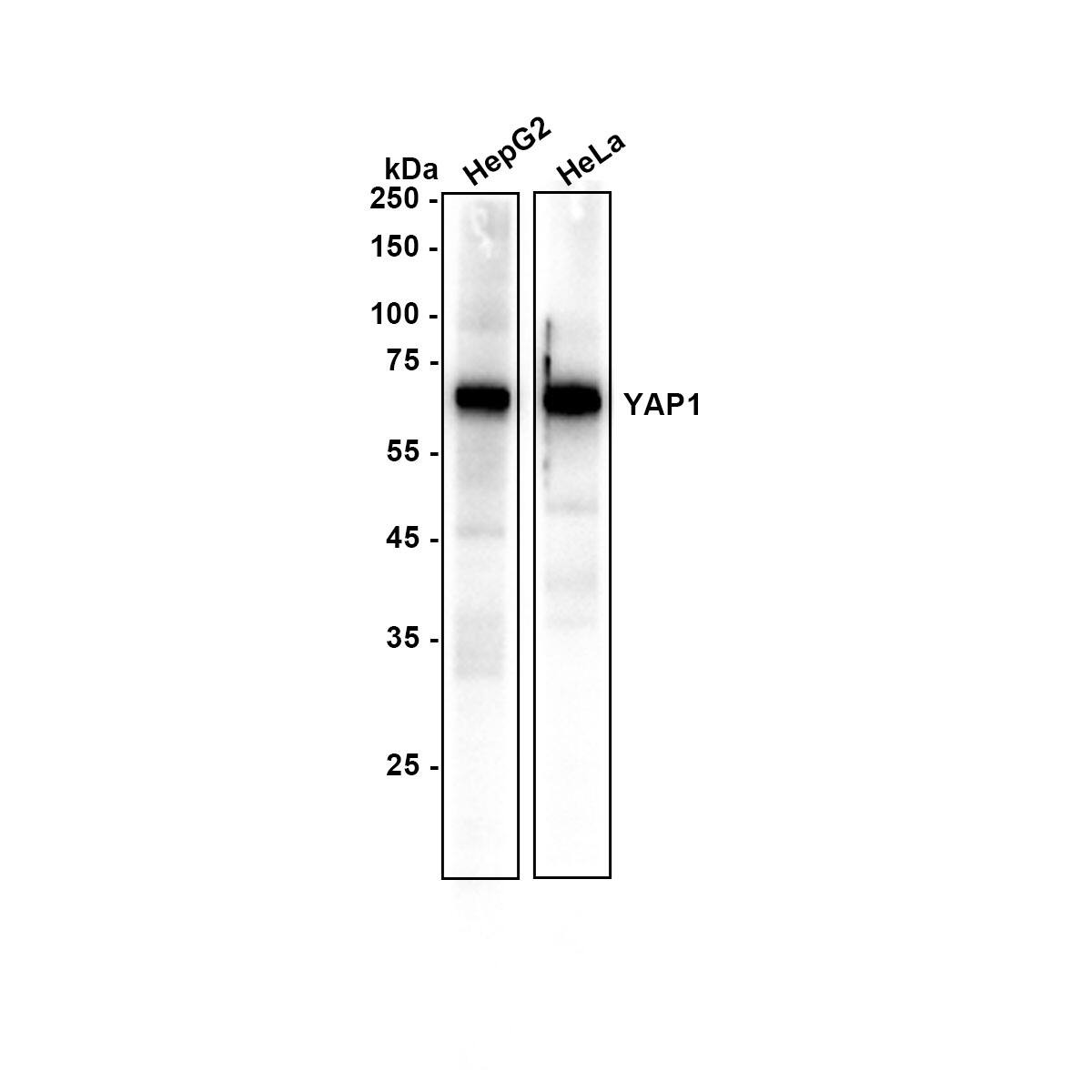 YAP1 Antibody (SU33-06) Western Blot: YAP1 Antibody (SU33-06) [NBP2-67467]