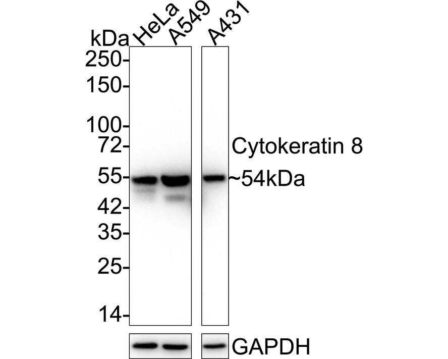 Cytokeratin 8 Antibody (SU0338) Western Blot: Cytokeratin 8 Antibody (SU0338) [NBP2-67468]