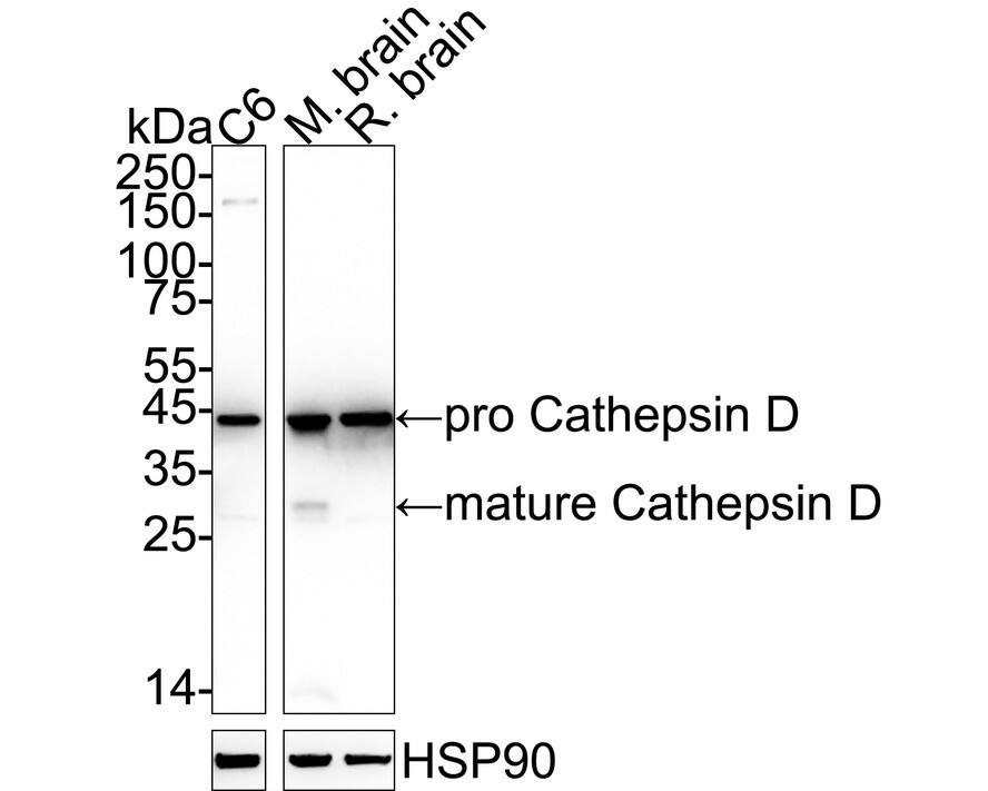 Cathepsin D Antibody (SU0360) Western Blot: Cathepsin D Antibody (SU0360) [NBP2-67477]