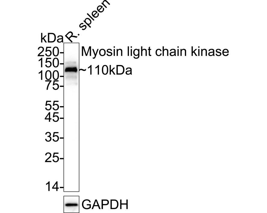 Myosin light chain kinase Antibody (SU40-06) Western Blot: Myosin light chain kinase Antibody (SU40-06) [NBP2-67486]