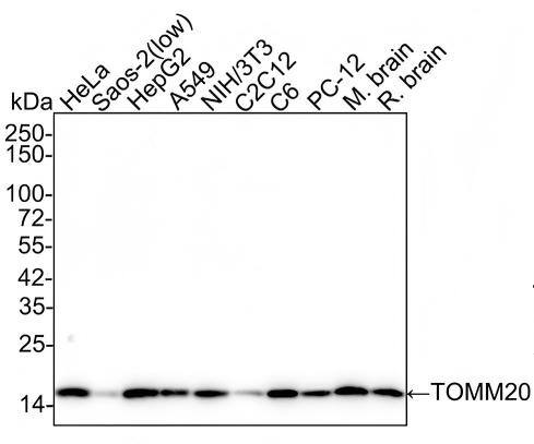 TOMM20 Antibody (ST04-72) Western Blot: TOMM20 Antibody (ST04-72) [NBP2-67501]