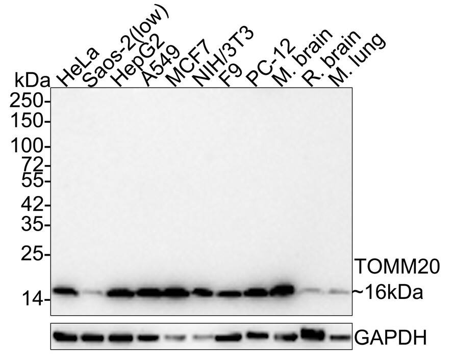 TOMM20 Antibody (ST04-72) Western Blot: TOMM20 Antibody (ST04-72) [NBP2-67501]